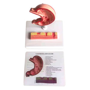 Modèle anatomique de l'estomac malade grandeur nature pour l'enseignement médical, modèle de gastrite et d'ulcère - Product Image 2