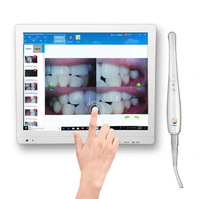 الكل في واحد ويندوز 10 OS عيادة الأسنان الأسنان أفضل كاميرا لاستكشاف الأسنان 17 بوصة كامل شاشة تعمل باللمس العالمي قوس شملت