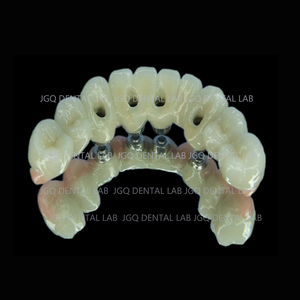 Tandheelkundige Zirkonia <span class=keywords><strong>Abutment</strong></span> En Tandheelkundige Schroefkronen Voor Tandheelkundig Implantaat - Product Image 1