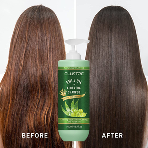 <span class=keywords><strong>Shampoo</strong></span> 2-in-1 Personalizzato <span class=keywords><strong>per</strong></span> Capelli Ricci, Vegano, Senza Silicone, Idratazione Profonda con Aloe Vera e Olio di Amla, Anti-Forfora <span class=keywords><strong>per</strong></span> <span class=keywords><strong>Cuoio</strong></span> <span class=keywords><strong>Capelluto</strong></span> Pruriginoso e Scamosciato - Product Image 4