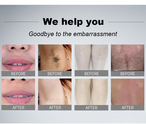 <span class=keywords><strong>Prix</strong></span> actif Équipement <span class=keywords><strong>laser</strong></span> médical <span class=keywords><strong>Professionnel</strong></span> 808 nm Ice Lazer Diode Device 808nm Diode <span class=keywords><strong>Laser</strong></span> <span class=keywords><strong>Épilation</strong></span> Machine - Product Image 5