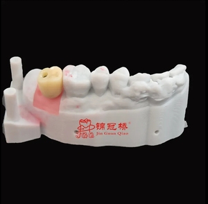 ส่วนบนของฟันเทียมไทเทเนียมพิมพ์ดิจิตอล3D แบบกำหนดเองเหมาะสำหรับระบบฝังหลัก - Product Image 6