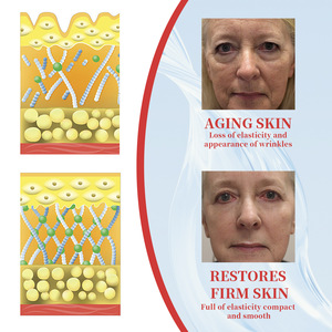 2025 Popular efecto significativo líneas finas arrugas pliegues nasolabiales aclaramiento de la piel suero facial antienvejecimiento - Product Image 4