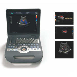 Escáner de Ultrasonido LTUB65, Máquina de Ultrasonido Doppler a Color 4D con <span class=keywords><strong>Precio</strong></span> Razonable, Sistema de Diagnóstico por Ultrasonido - Product Image 2