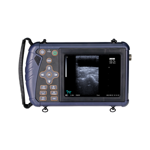 बी/डब्ल्यू गर्भावस्था निदान के लिए अल्ट्रासाउंड रैखिक जांच पशु अल्ट्रासाउंड नैदानिक प्रणाली - Product Image 2
