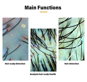뷰티 살롱 탈모 두피 스캐너 인쇄 보고서 2025 AI 지능형 고객 파일 관리 최고의 두피 분석기 기계 - Product Image 6