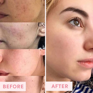 Limpiador de poros faciales, exfoliante <span class=keywords><strong>para</strong></span> la piel, blanqueador de sal Rosa <span class=keywords><strong>Natural</strong></span> orgánica de etiqueta privada, fabricantes de cosméticos - Product Image 4