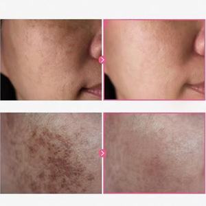 <span class=keywords><strong>Crema</strong></span> <span class=keywords><strong>Viso</strong></span> Tosswong a Basso Costo per Rimuovere l'Acne con Arbutina e Niacinamide per Uniformare il Tono della Pelle - Product Image 5