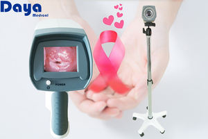 Colposcope vidéo de qualité clinique Daya - Appareil de dépistage cervical numérique pour la santé des femmes - Product Image 6