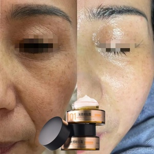 Crème éclaircissante pour le <span class=keywords><strong>visage</strong></span>, traitement de l'hyperpigmentation post-inflammatoire, suppléments pour la peau pour un éclat et un blanchiment de la peau - Product Image 1