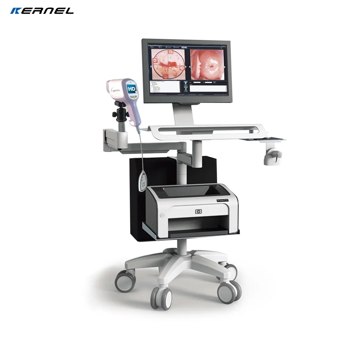 Colposcopio electrónico de alta calidad para prevenir enfermedades ginecológicas, colposcopio electrónico para clínicas ginecológicas de hospitales