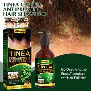 Champú Anticaspa y Antipruriginoso South Moon Tinea Capitis, Champú de Aminoácidos para Cabello Suave, Marca Privada - Product Image 6