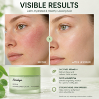 Crème Sorbet Apaisante et Réparatrice OEM/ODM à la Centella, Niacinamide Hydratante et Apaisante, Soin Après-Soleil, Hydratant Visage