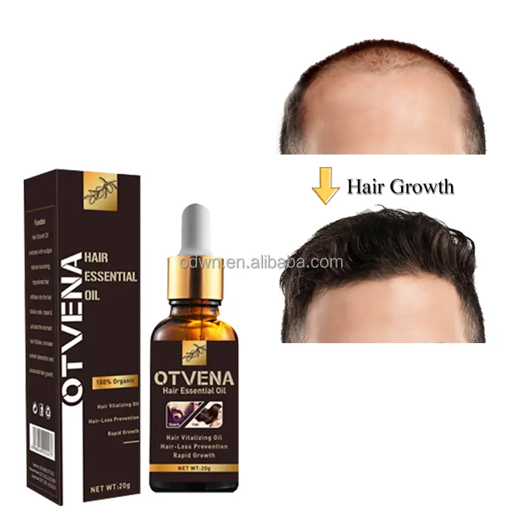 Aceite orgánico para el cuidado del cabello, Tratamiento capilar natural para la pérdida de cabello, productos de reparación de aceite para hombres y mujeres con logotipo personalizado