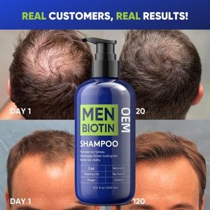 Cina fabbrica eco-friendly 400Ml uomini <span class=keywords><strong>Shampoo</strong></span> con biotina prevenire la perdita di <span class=keywords><strong>capelli</strong></span> follicolo rafforzamento Boost <span class=keywords><strong>crescita</strong></span> dei <span class=keywords><strong>capelli</strong></span> <span class=keywords><strong>Shampoo</strong></span> - Product Image 2