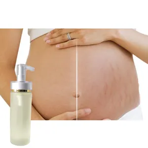 Minyak Perbaikan Bekas Luka dan Stretch Mark Organik Digunakan Pada Kulit untuk Memulihkan Keriput, Mengucapkan Selamat Tinggal Pada Bekas Luka dan Mendapatkan Kekokangan