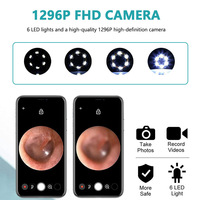 NE3 Herramienta Inalámbrica Visible para Limpieza de Oídos, Cámara para Remover Cera de Oídos con 1080P