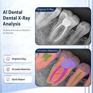 Appareil de <span class=keywords><strong>radiographie</strong></span> numérique avec capteur IA pour la pratique <span class=keywords><strong>dentaire</strong></span> moderne, système d'imagerie radiographique intra-orale - Product Image 3
