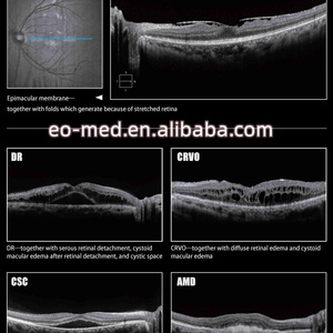 Appareil ophtalmique haut de gamme, machine OCT optique avec cartographie du segment avant et du fond d'œil, tomographie par cohérence optique OCT20 - Product Image 6