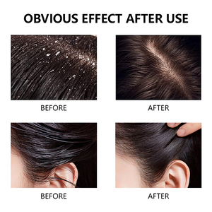 <span class=keywords><strong>Shampoo</strong></span> Gel OEM alle Erbe e Limone <span class=keywords><strong>Antiforfora</strong></span>, Purificante, Illuminante, Idratante e Nutriente per un Cuoio Capelluto Sano - Product Image 5