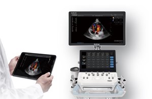 Échographe vétérinaire Sonoscape Propet 60 à haute résistance à l'abrasion avec imagerie Doppler du flux sanguin pour animaux de compagnie - Product Image 3