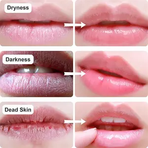 Benutzer definierte OEM Hydro gel Anti-Falten-Behandlung Lippen pflege maske Korean Beauty Moist urizing 24K Gold Hot Pink Kollagen Lippen maske