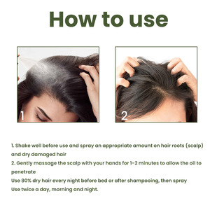 สเปรย์บำรุงเส้นผมสูตรองุ่น ขายดี OEM/ODM ช่วยฟื้นฟูรากผมอย่างล้ำลึก ลดการหลุดร่วง บำรุงด้วยน้ำมันหอมระเหย - Product Image 6