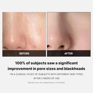 Medicube Zero Pore Pads 2.0 Contienen Ácido Láctico y Pantenol, Discos Tónicos Hidratantes y Calmantes, Aptos <span class=keywords><strong>para</strong></span> Todo Tipo de Piel - Product Image 4