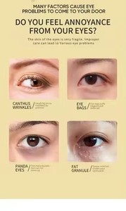 Masques Patchs Contour des Yeux Éclaircissants à la Vitamine C et à l'Aloe Vera, Hydratants <span class=keywords><strong>Anti</strong></span>-<span class=keywords><strong>Cernes</strong></span>, Écologiques, Prix de Gros, Vente en Gros - Product Image 4