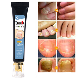 <span class=keywords><strong>Crema</strong></span> de reparación de <span class=keywords><strong>uñas</strong></span> hidratante profunda de etiqueta privada para <span class=keywords><strong>manos</strong></span> y pies OEM cuidado del cuerpo eficaz <span class=keywords><strong>crema</strong></span> de tratamiento de <span class=keywords><strong>hongos</strong></span> en las <span class=keywords><strong>uñas</strong></span> - Product Image 1