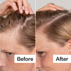 Olio Essenziale <span class=keywords><strong>di</strong></span> Rosmarino Naturale e Biologico con Logo Personalizzato, Siero Nutriente per Cuoio Capelluto e Capelli, Olio <span class=keywords><strong>di</strong></span> Batana per la Crescita dei Capelli - Product Image 5