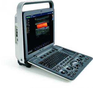 Sonoscape S8 Exp Draagbare Kleur Doppler Echografie Voor Veterinaire Dieren Handheld Veterinaire Echografie Machine - Product Image 3