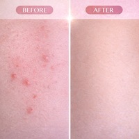 Minyak Esensial Cyperus Rotundus Roll-On Private Label 60ml, Serum Perawatan Kulit Tubuh Setelah Penghilangan Rambut, Menenangkan dan Melembapkan, OEM ODM