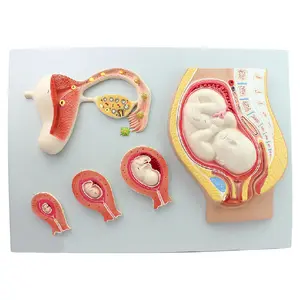 Tıbbi bilim insan hamile embriyo fetus geliştirme modeli modeli Uterine anatomi modeli