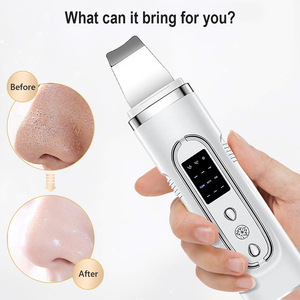 <b>Face</b> Nose Ultrasonic Facial Skin <b>Scrubber</b> 24kHz Ultrasonic Skin <b>Scrubber</b> for Pore Deep Cleansing - Product Image 3