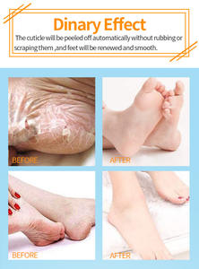 Masque exfoliant hydratant jetable de beauté des pieds d'extrait de plantes de marque privée - Product Image 5