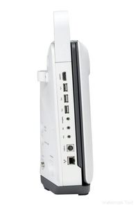 Mesin Ultrasound Sonoscape Doppler warna lebih baik dari bandray Z6 - Product Image 2