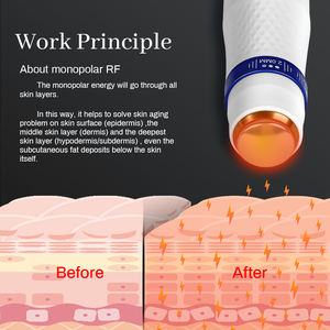 Synogal - Máquina <span class=keywords><strong>HIFU</strong></span> Portátil No Invasiva UR Max de Alta Intensidad con Ultrasonido Focalizado y Electroporación EMS para Salón - Product Image 2
