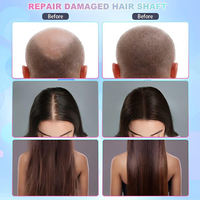 50X 200X Camera Hair Follicle Loss Treatment Device Relieves Itching Scalp Analysis 5 in 1 Hair and Scalp Analyzer Machine