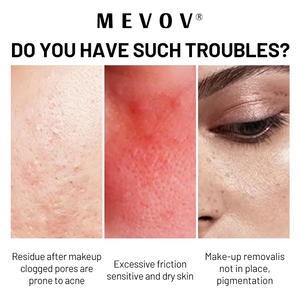 <span class=keywords><strong>Agua</strong></span> <span class=keywords><strong>micelar</strong></span> de etiqueta privada, limpieza refrescante, eliminación de maquillaje para la cara - Product Image 4