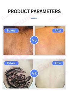 Produits Tendances 2026 pour les Entreprises : Appareil de Refroidissement Cutané au <span class=keywords><strong>Laser</strong></span> -35°C 1200W, Dispositif de Refroidissement à Air Froid 9 Vitesses, Faible Bruit - Product Image 5