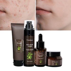 Set <span class=keywords><strong>de</strong></span> Cuidado Facial <span class=keywords><strong>para</strong></span> el Acné <span class=keywords><strong>de</strong></span> Marca Privada <span class=keywords><strong>para</strong></span> <span class=keywords><strong>Piel</strong></span> <span class=keywords><strong>Grasa</strong></span>, Hidratante, Reparador <span class=keywords><strong>de</strong></span> Barrera, Cosméticos Orgánicos, <span class=keywords><strong>Kit</strong></span> <span class=keywords><strong>de</strong></span> Cuidado Facial Coreano - Product Image 1