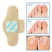 Patchs adoucissants pour ongles incarnés, respirants, anti-infection, antifongiques, réparation nocturne, soin des ongles des pieds