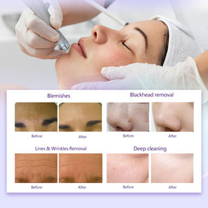 HydraMaster Beauty Korea 9 en 1 Diamond Professional Hydro Skin Analysis Machine para el cuidado de la piel facial - Product Image 6