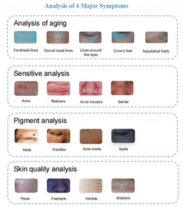 3D <b>Skin</b> Analyzer <b>Machine</b> Multi-Dimensional <b>Analysis</b> Wrinkle Melanin Detection Dermatoscope Face Tester AI Technology Soft Safe - Product Image 6