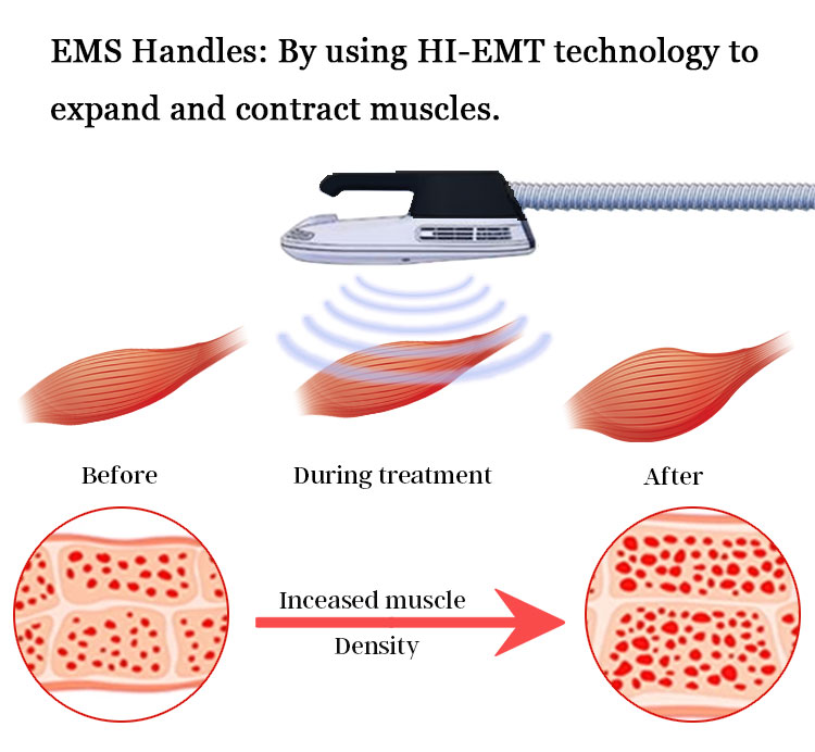 2022 Professional fat burning muscle building hiemt machine cellulite removal weight loss 360 cryo machine