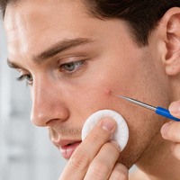 Aiguille jetable pour éliminer les points noirs, lancette anti-acné pour usage en salon de beauté