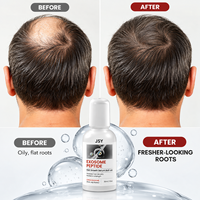 Serum Kulit Kepala Roll-On Peptida Eksosom Label Pribadi, Perawatan Kondisioner Ringan untuk Kulit Kepala Segar dan Rambut Terlihat Sehat 30 ml