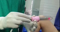 Appareil de traitement au laser fractionné au CO2 médical 30W pour le rajeunissement de la peau et le resserrement vaginal
