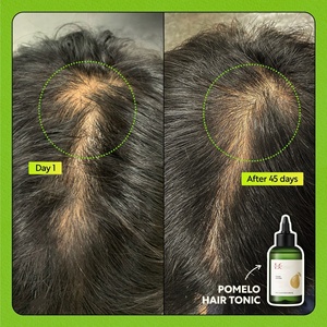 Lance Private Label <span class=keywords><strong>tonico</strong></span> per capelli 100% <span class=keywords><strong>naturale</strong></span> vegano promuovere la crescita dei capelli Anti perdita di importazione rottura nutre il cuoio capelluto per capelli sani - Product Image 4